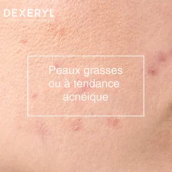 Application Dexeryl Gel Moussant sur visage massage nettoyage peau grasse anti-imperfections