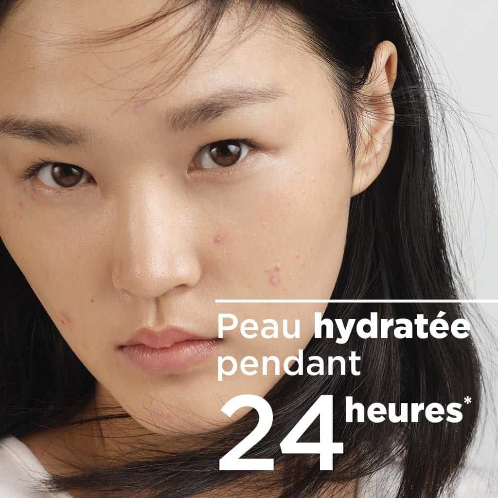 Visage d'une femme avec peau grasse et hydratée, utilisant la crème Sébium Hydra BIODERMA.