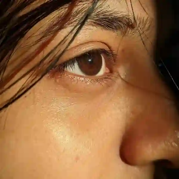 Peau Grasse Algérie