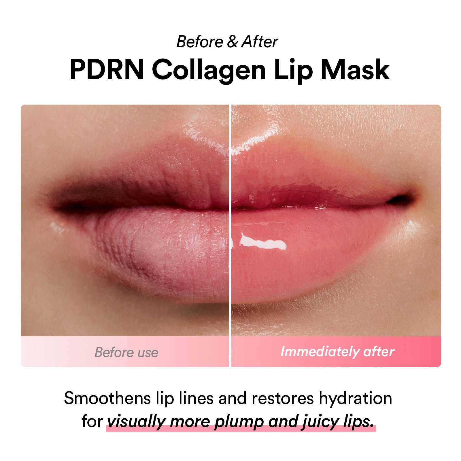 Abib PDRN Collagen Lip Mask Glazed Jelly Masque Lèvres 11g – Image 3