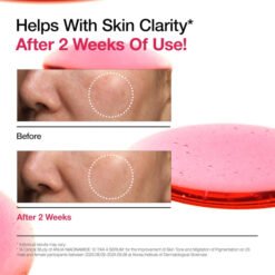 ANUA Niacinamide 10% + TXA 4% Sérum Anti-Taches Correcteur 30ml – Image 3
