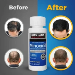 KIRKLAND Minoxidil 5%