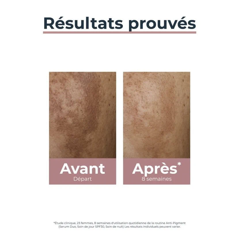 Eucerin Anti-Pigment Soin de Jour SPF 30 50ml – Image 2