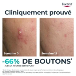 Eucerin DermoPure Clinical Fluide Triple Action 40ml