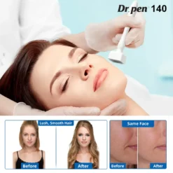 Alternative view of Dr Pen DRS 140 Derma Stamp Microneedling Réglable 0.2-3mm