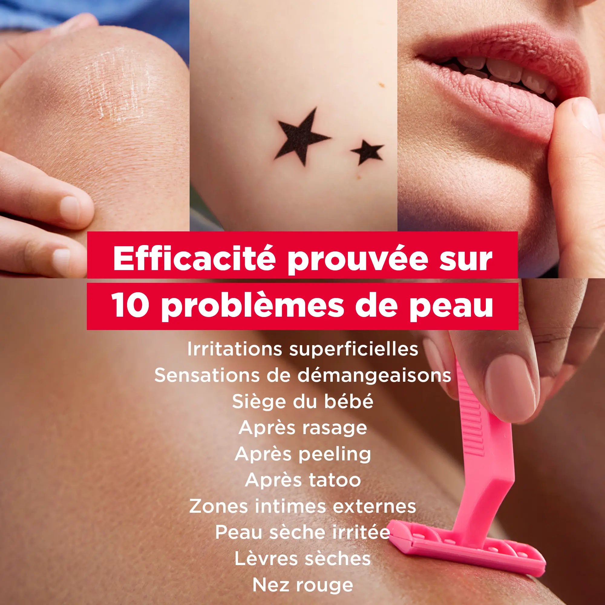 Mixa Balm Cica+ Baume Réparateur Multifonctionnel Peaux Sèches 50ml – Image 4