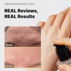 COSRX Advanced Snail 96 Mucin Power Essence 100ml – Image 3