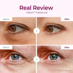 Dr. Melaxin Cemenrete Calcium Volume Eye Patch 60 Patchs Hydrogel – Image 3