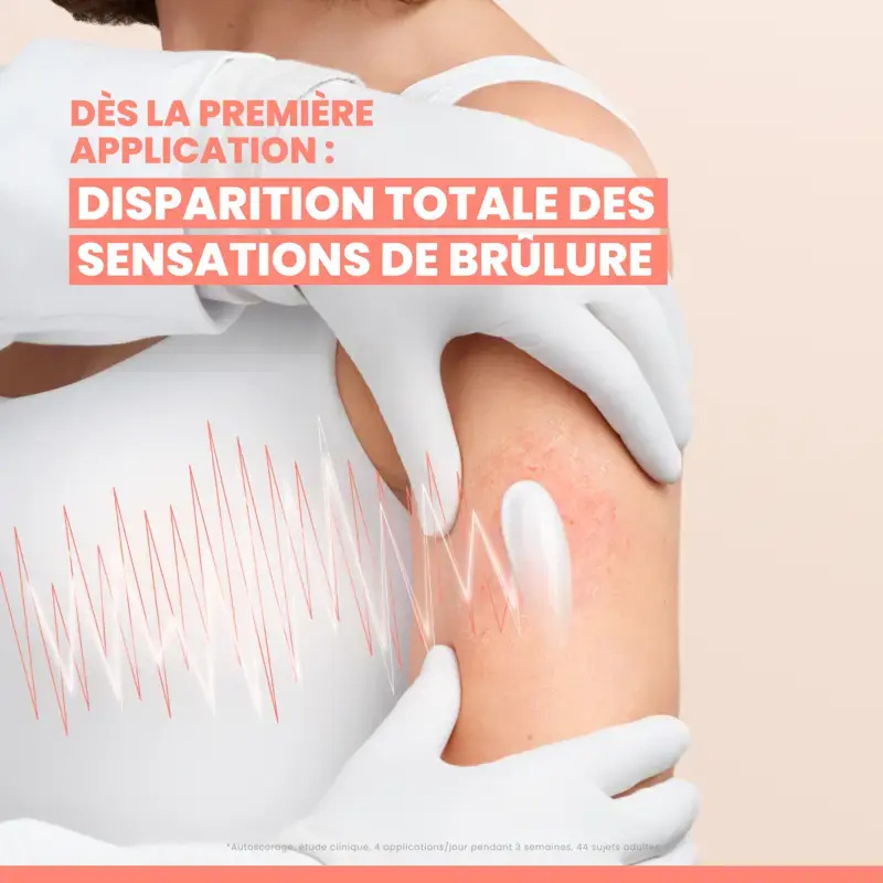 Avène XeraCalm A.D Concentré Apaisant I-modulia Démangeaisons Intenses 40ml – Image 4