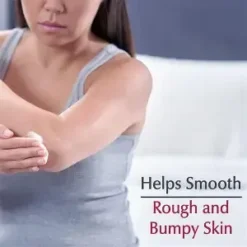 Eucerin Roughness Relief Cream Anti-Rugosités 10% Urée AHA Céramide 454g – Image 4