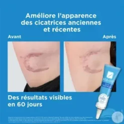 Kelo-Cote Gel Silicone Cicatrices 15g – Image 2