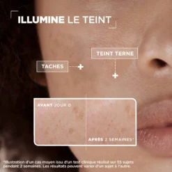 Mixa Sérum Concentré Anti-Taches Vitamine Cg Acide Glycolique Niacinamide AH 30ml – Image 4
