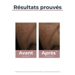 Eucerin Anti-Pigment Correcteur Taches Thiamidol Brevet Glucosylrutin Applicateur Local – Image 4